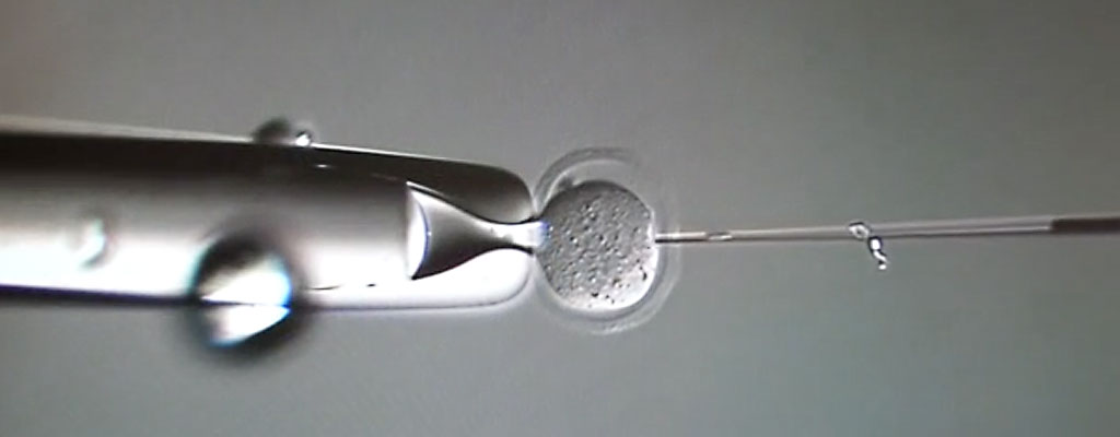 biogenesis research microscopic needle